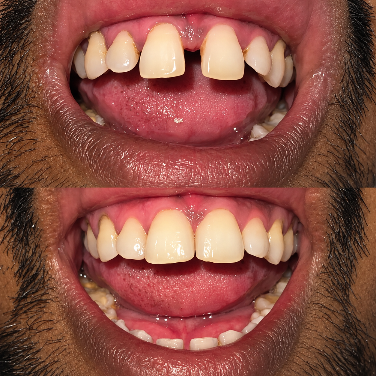 Case 2 Before and After